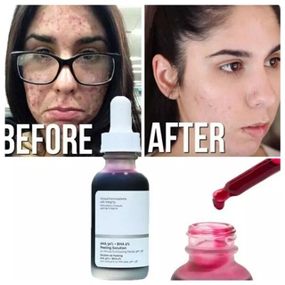 Wantfashion1 30ml AHA 30% + BHA 2% solución de Peeling 10 minutos exfoliante facial iluminar suero cuidado de la piel cara