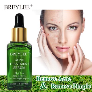Breylee tratamiento del acné suero esencia Facial Anti acné crema blanqueamiento espinillas (40 ml) (1)