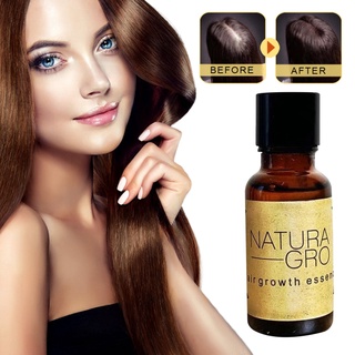 20G Hair Growth Serum Hair Growth Essential Oil Anti Detachment Repair Scalp Hair Care Solution