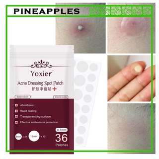 Acne Patch 36 Patches Cover Hydrocolloid Facial Stickers Pimple Spot Acne Patches for Face