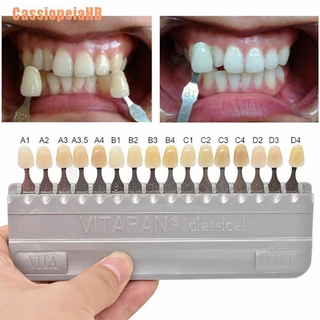 (cassiopeiahb) 1set de porcelana dentista material equipo de dientes whiting vita pan classial (8)