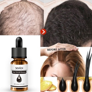 20ML cuidado del cabello crecimiento del cabello aceites esenciales esencia crecer fluido cabello aceite Essense
