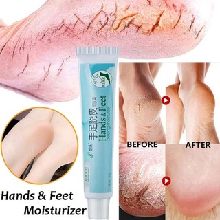 mxgha crema hidratante de manos y pies crema corporal hidrata la piel para los pies hidratante manos peeling seco severamente y3v3 (3)