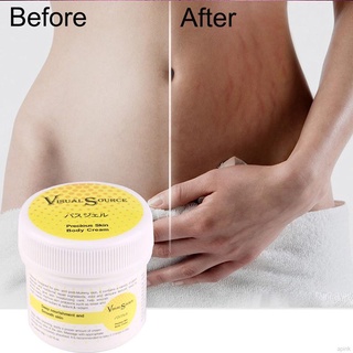 crema de eliminación de estrías suave maternidad reparación de la piel cuidado corporal