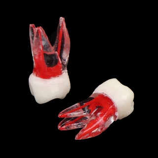 [daydayto] Modelo de endodóntico Dental de resina/modelo de pulpa de conducto radicular de color/herramientas de dentista [MY]