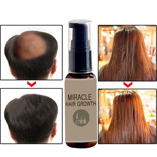 30ml cuidado del cabello aceite esencial de crecimiento del cabello aceite esencial anti pérdida de cabello aceite esencial
