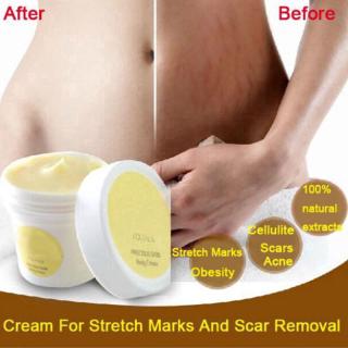 Thai Pasjel crema de reparación de estrías nutre la piel del cuerpo, elimina rápidamente las estrías, crema de reparación corporal madre